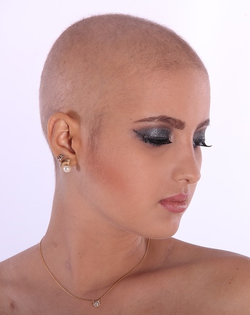 Выпадение волос при химиотерапии лечение, причины. Как лечить выпадение волос после химиотерапии